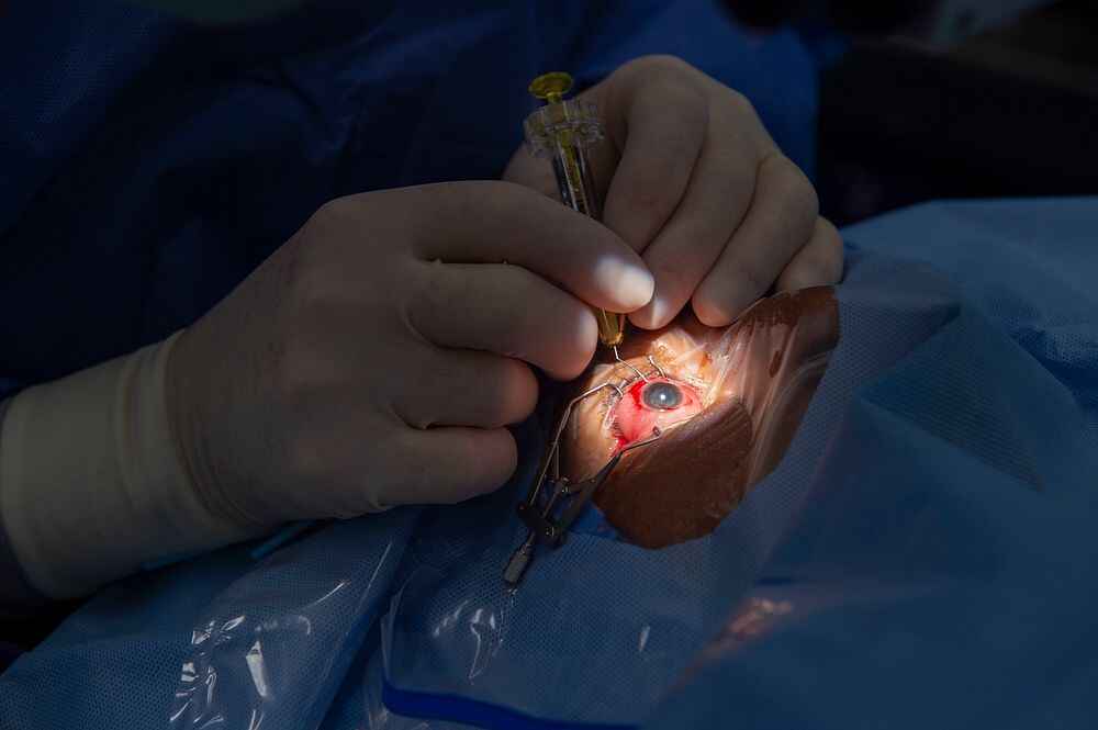 squint surgery in delhi